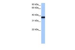 GSG1 Rabbit anti-Human, Polyclonal, Novus Biologicals 0.1 mL | Buy Online | Novus Biologicals | Fisher Scientific